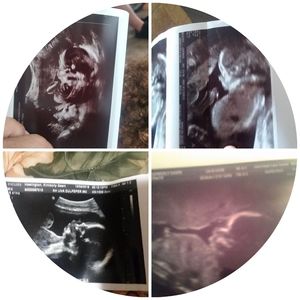 Meet your Posher, Kimandaalaya